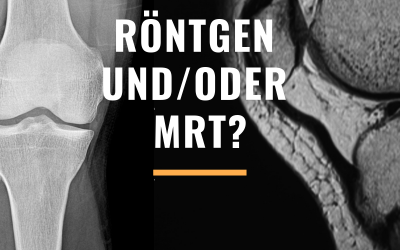Röntgen und/oder MRT bei der Diagnose Kreuzbandriss?